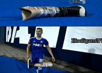 Απίστευτο και όμως αληθινό – Οπαδός πέταξε το πόδι του στο γήπεδο!